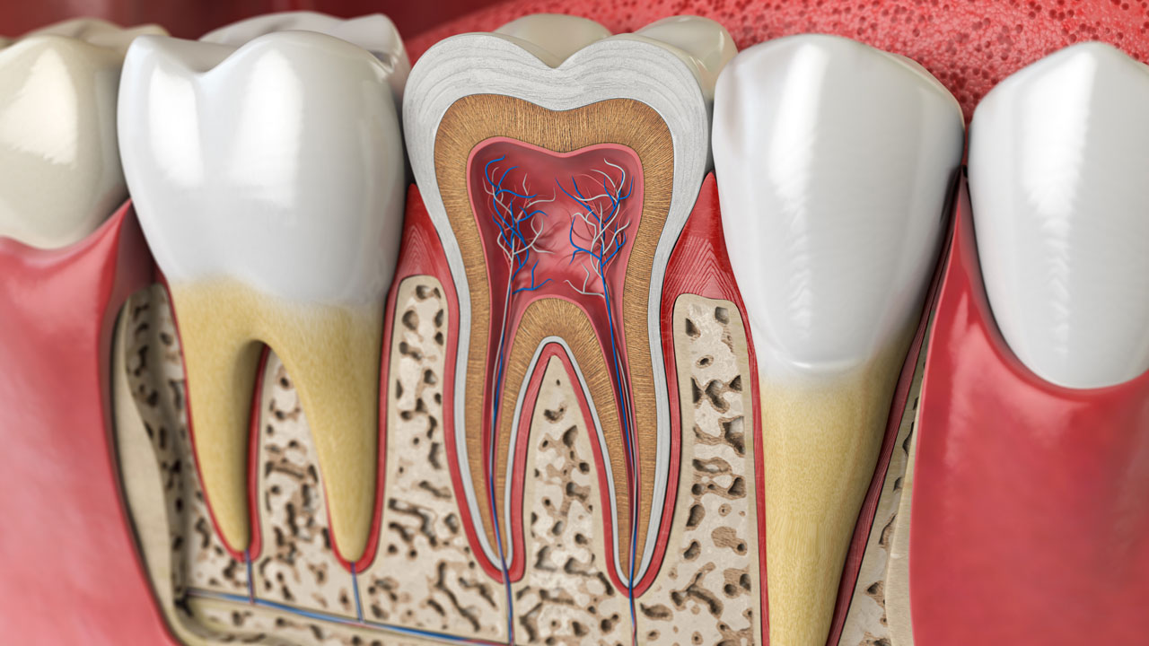 Root Canals